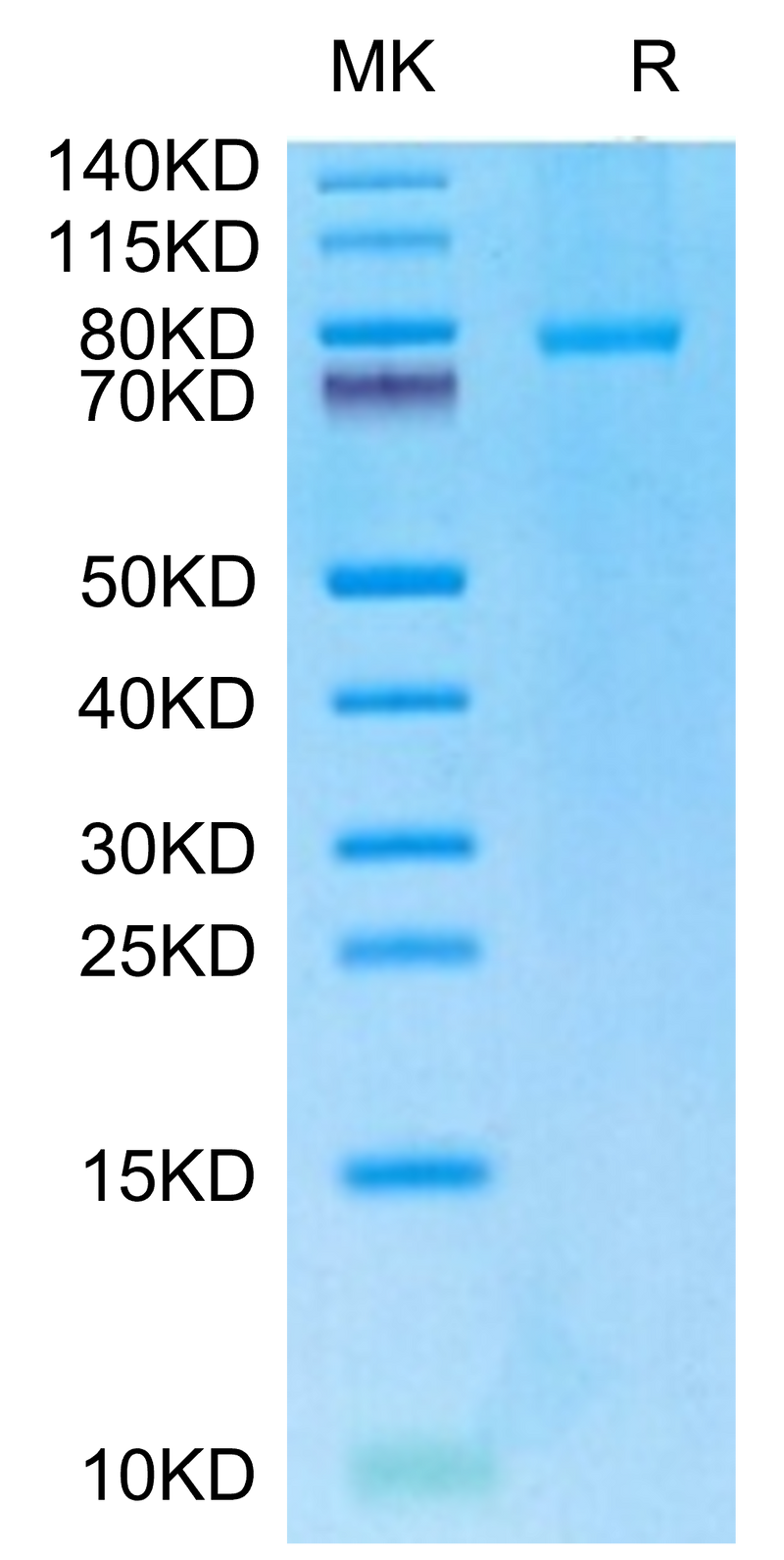 Human CD40 Ligand (Trimer) on Tris-Bis PAGE under reduced condition. The purity is greater than 95%.