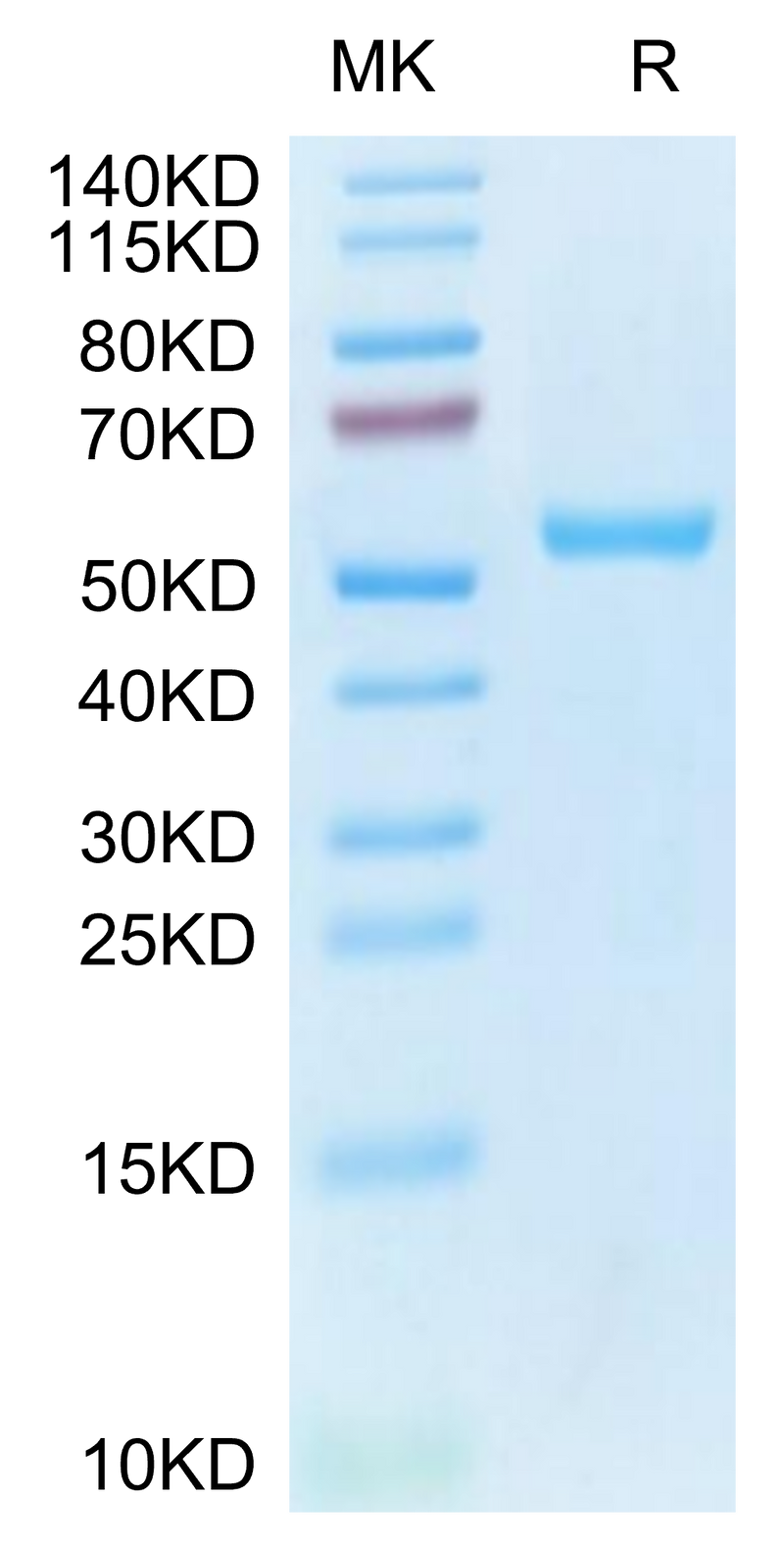 Human HLA-A*02:01&B2M&MAGE-A4 (KVLEHVVRV) Monomer on Tris-Bis PAGE under reduced condition. The purity is greater than 95%.