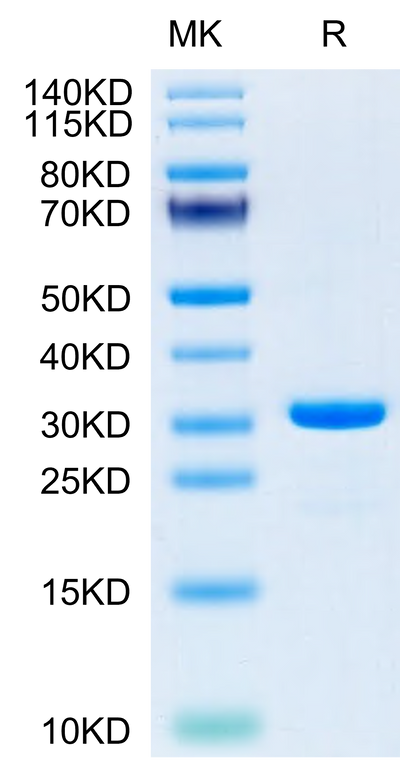 SARS-CoV-2 3CLpro (E166A) on Tris-Bis PAGE under reduced condition. The purity is greater than 95%.