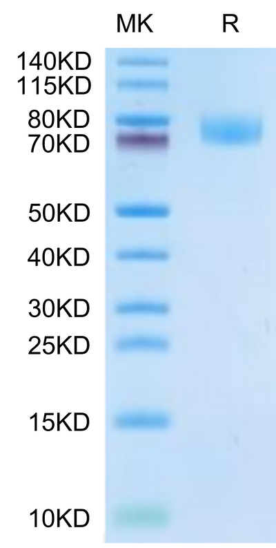 Cynomolgus ALCAM on Tris-Bis PAGE under reduced condition. The purity is greater than 95%.