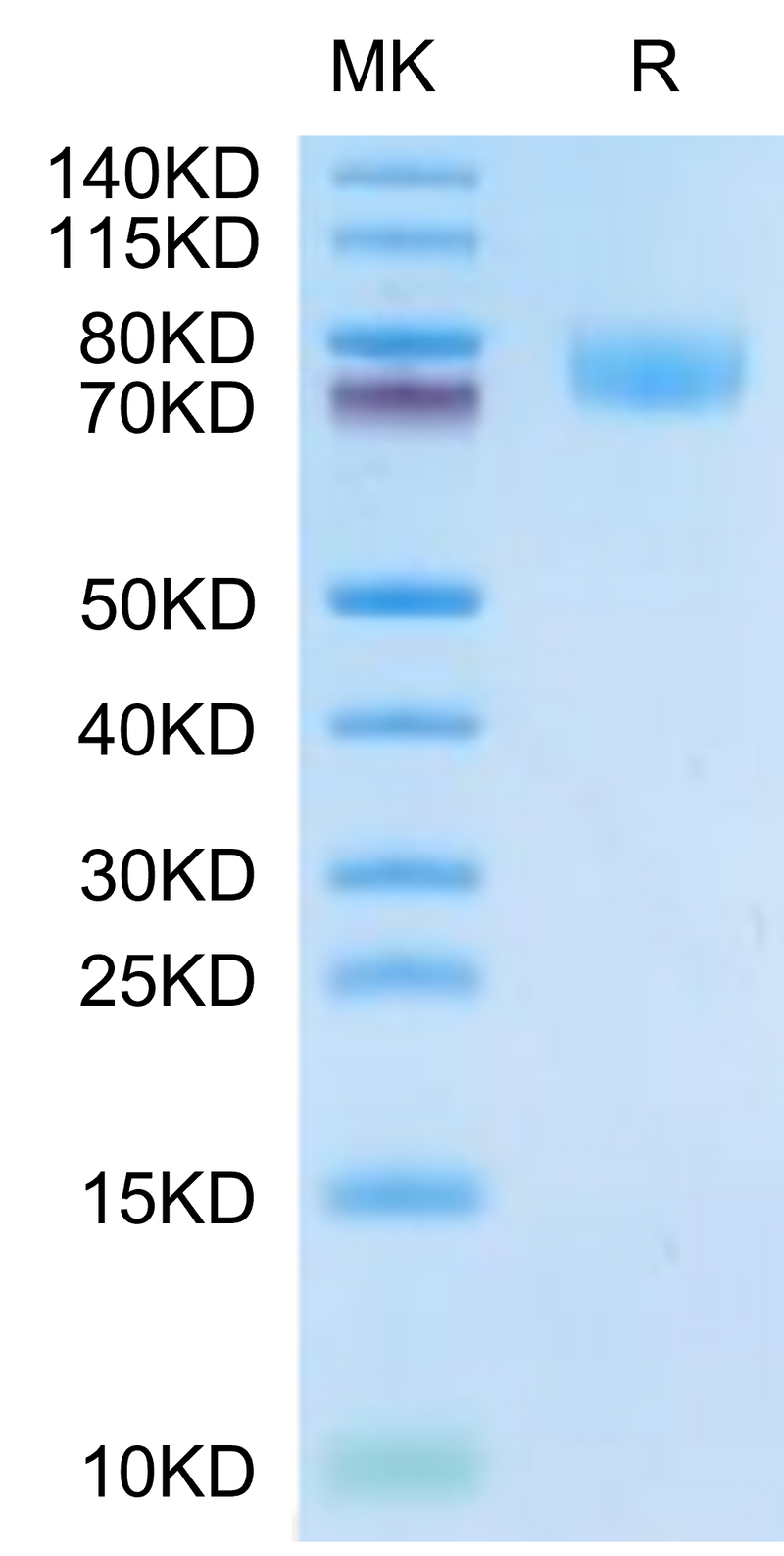 Cynomolgus ALCAM on Tris-Bis PAGE under reduced condition. The purity is greater than 95%.