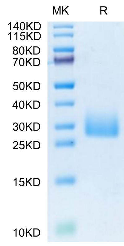 Mouse CD161 on Tris-Bis PAGE under reduced condition. The purity is greater than 95%.