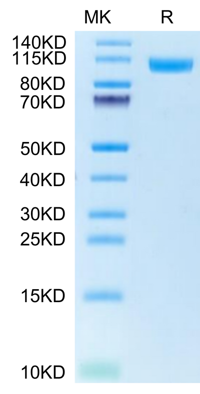 Human NCAM-1 on Tris-Bis PAGE under reduced condition. The purity is greater than 95%.