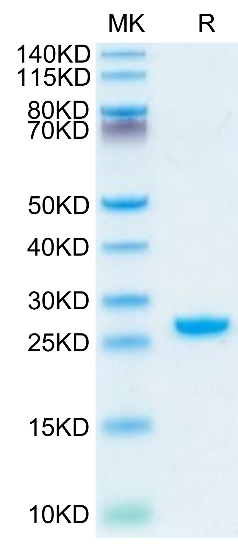 Rhesus macaque Complement Factor D on Tris-Bis PAGE under reduced condition. The purity is greater than 95%.