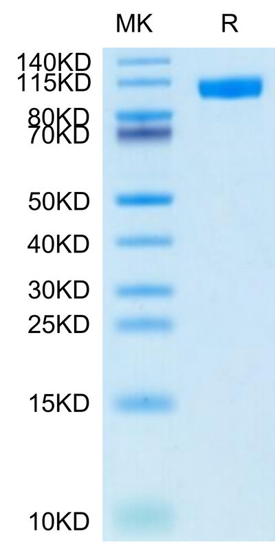 Cynomolgus NCAM-1 on Tris-Bis PAGE under reduced condition. The purity is greater than 95%.