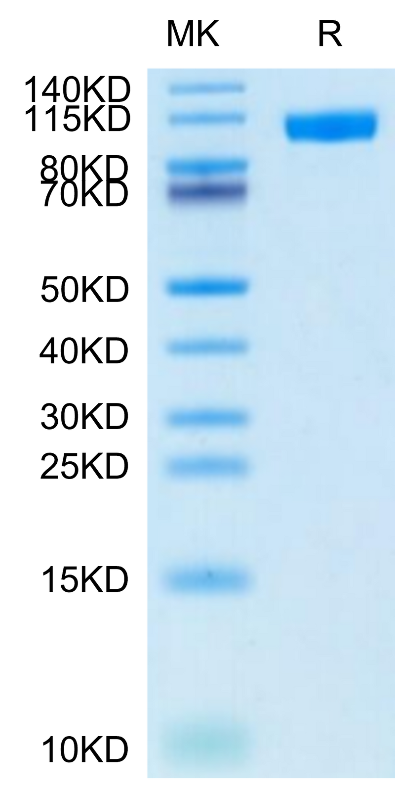 Cynomolgus NCAM-1 on Tris-Bis PAGE under reduced condition. The purity is greater than 95%.