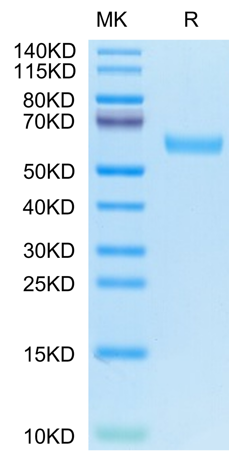 Human CD7 on Tris-Bis PAGE under reduced condition. The purity is greater than 95%.