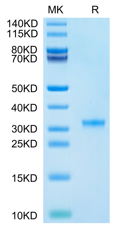 SARS-CoV-2 3CLpro (P132H) on Tris-Bis PAGE under reduced condition. The purity is greater than 95%.