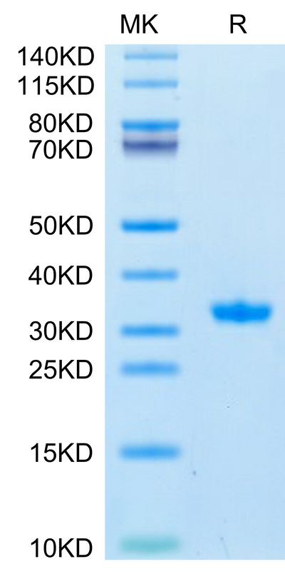 SARS-CoV-2 3CLpro (Q189K) on Tris-Bis PAGE under reduced condition. The purity is greater than 95%.