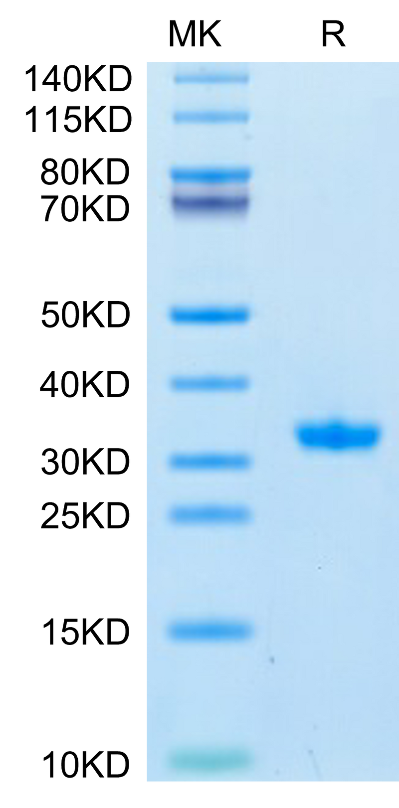 SARS-CoV-2 3CLpro (Q189K) on Tris-Bis PAGE under reduced condition. The purity is greater than 95%.