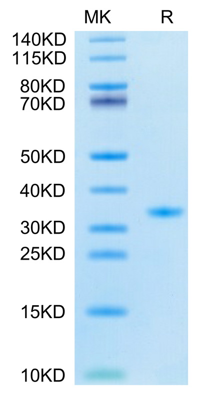 SARS-CoV-2 3CLpro (F140A) on Tris-Bis PAGE under reduced condition. The purity is greater than 95%.