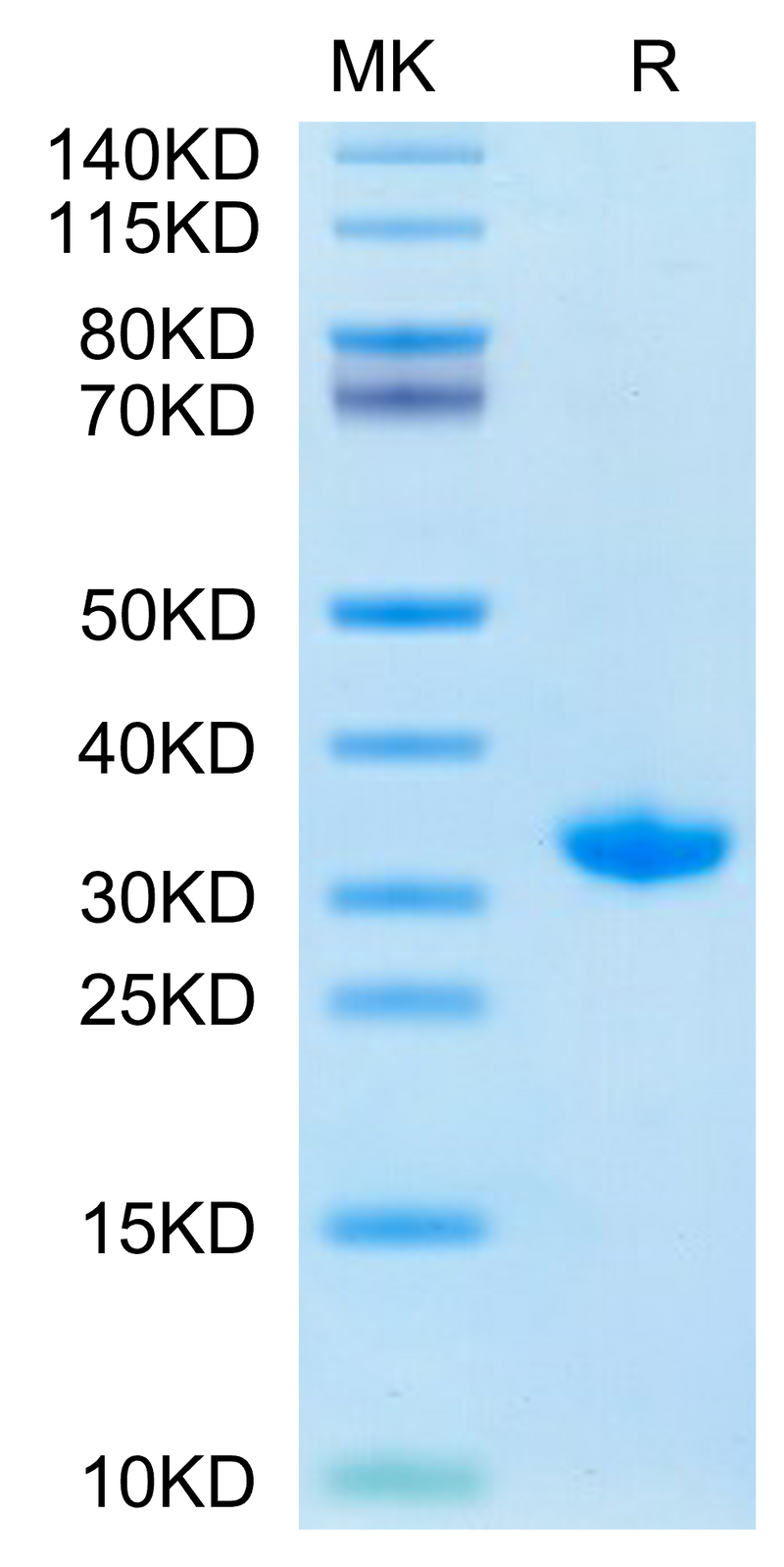 SARS-CoV-2 3CLpro (S144A) on Tris-Bis PAGE under reduced condition. The purity is greater than 95%.