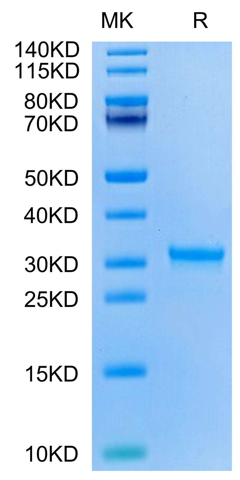 SARS-CoV-2 3CLpro (H172Y) on Tris-Bis PAGE under reduced condition. The purity is greater than 95%.