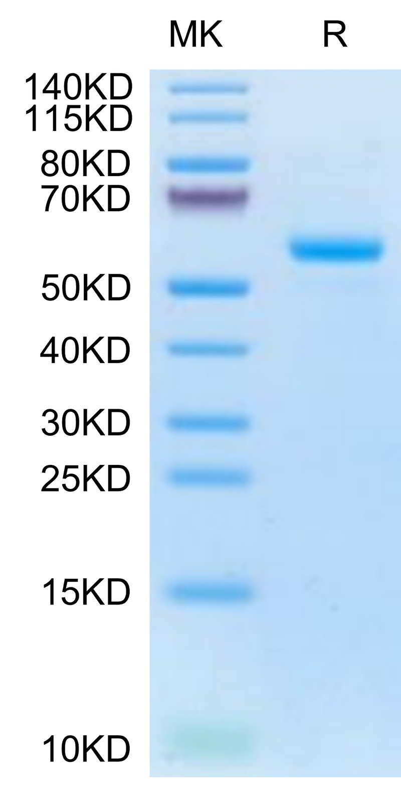 Human LAG3 on Tris-Bis PAGE under reduced condition. The purity is greater than 95%.