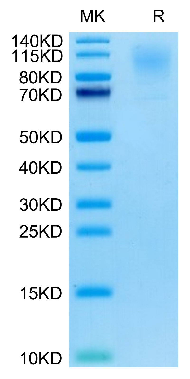 Cynomolgus CD43 on Tris-Bis PAGE under reduced condition. The purity is greater than 95%.