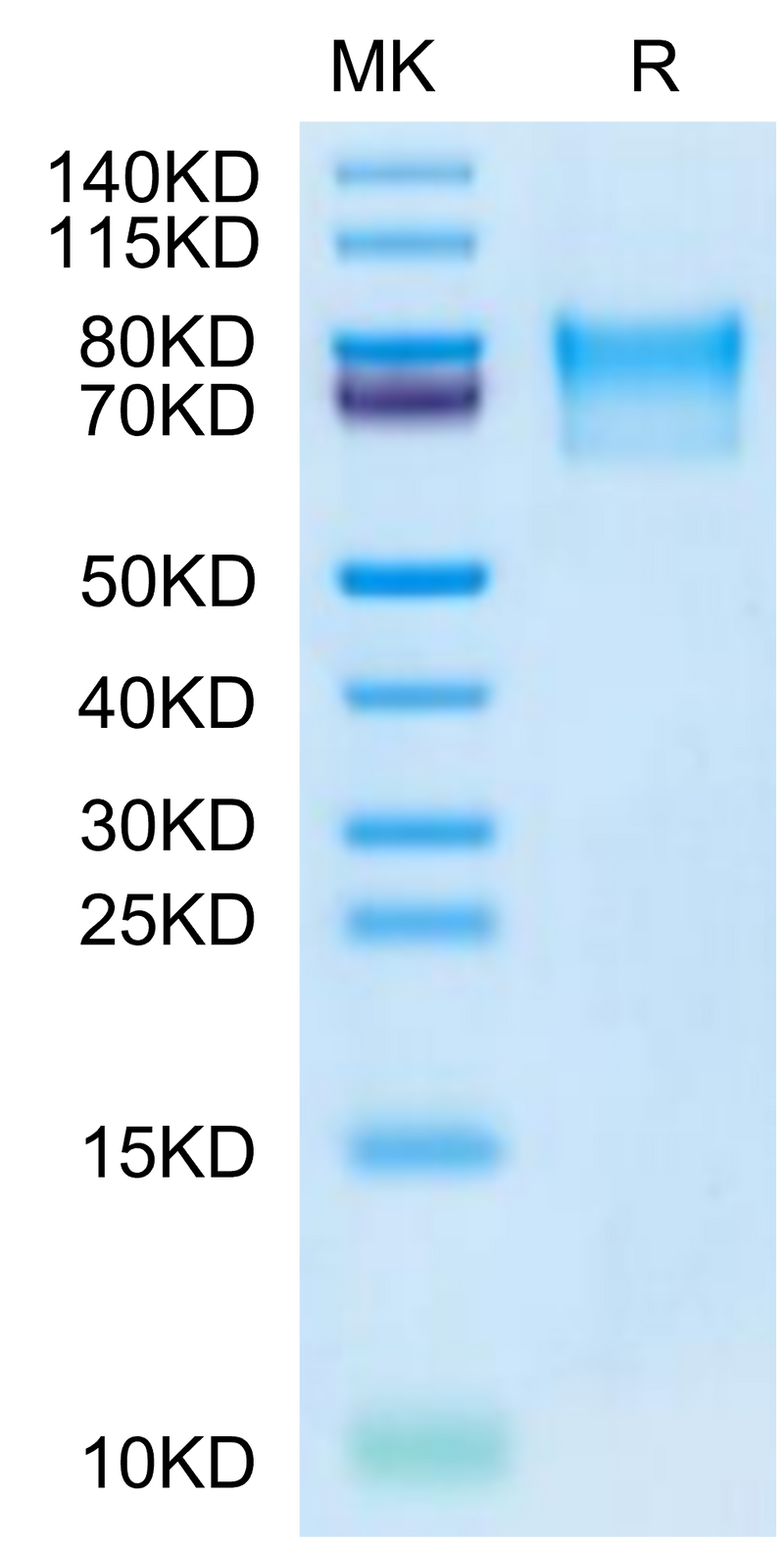 Varicella-zoster virus (strain Oka vaccine) Envelope glycoprotein E on Tris-Bis PAGE under reduced condition. The purity is greater than 95%.