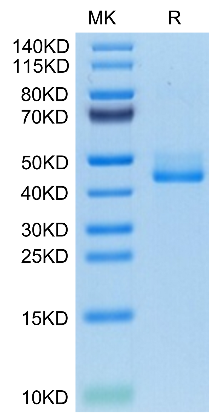 Human BAFFR on Tris-Bis PAGE under reduced condition. The purity is greater than 95%.