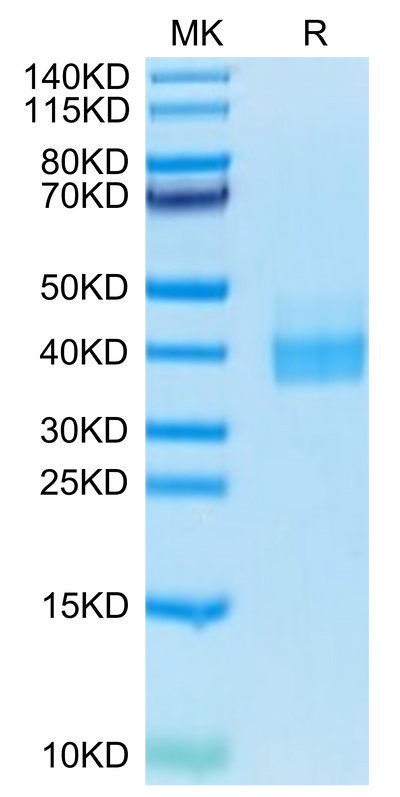 Biotinylated Human PD-L1 on Tris-Bis PAGE under reduced condition. The purity is greater than 95%.