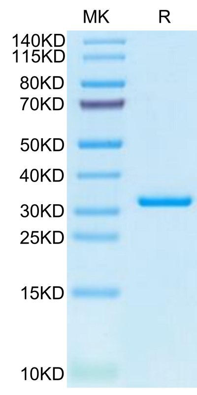 SARS-CoV-2 3CLpro (L50F, E166V) on Tris-Bis PAGE under reduced condition. The purity is greater than 95%.