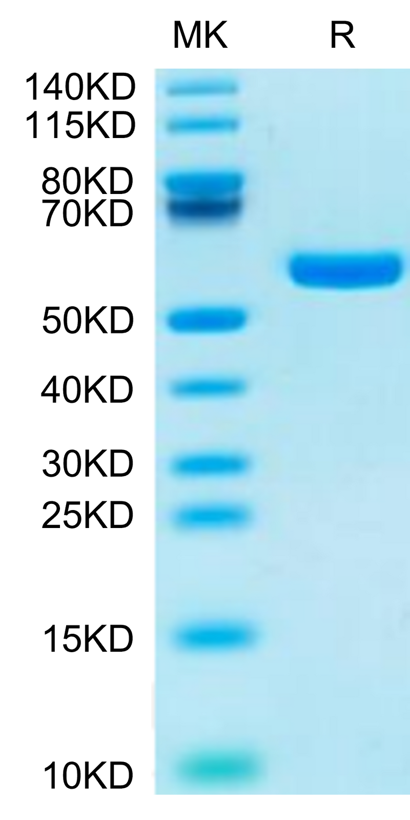 Human HLA-A*11:01&B2M&KRAS G12R (VVVGARGVGK) Monomer on Tris-Bis PAGE under reduced condition. The purity is greater than 95%.