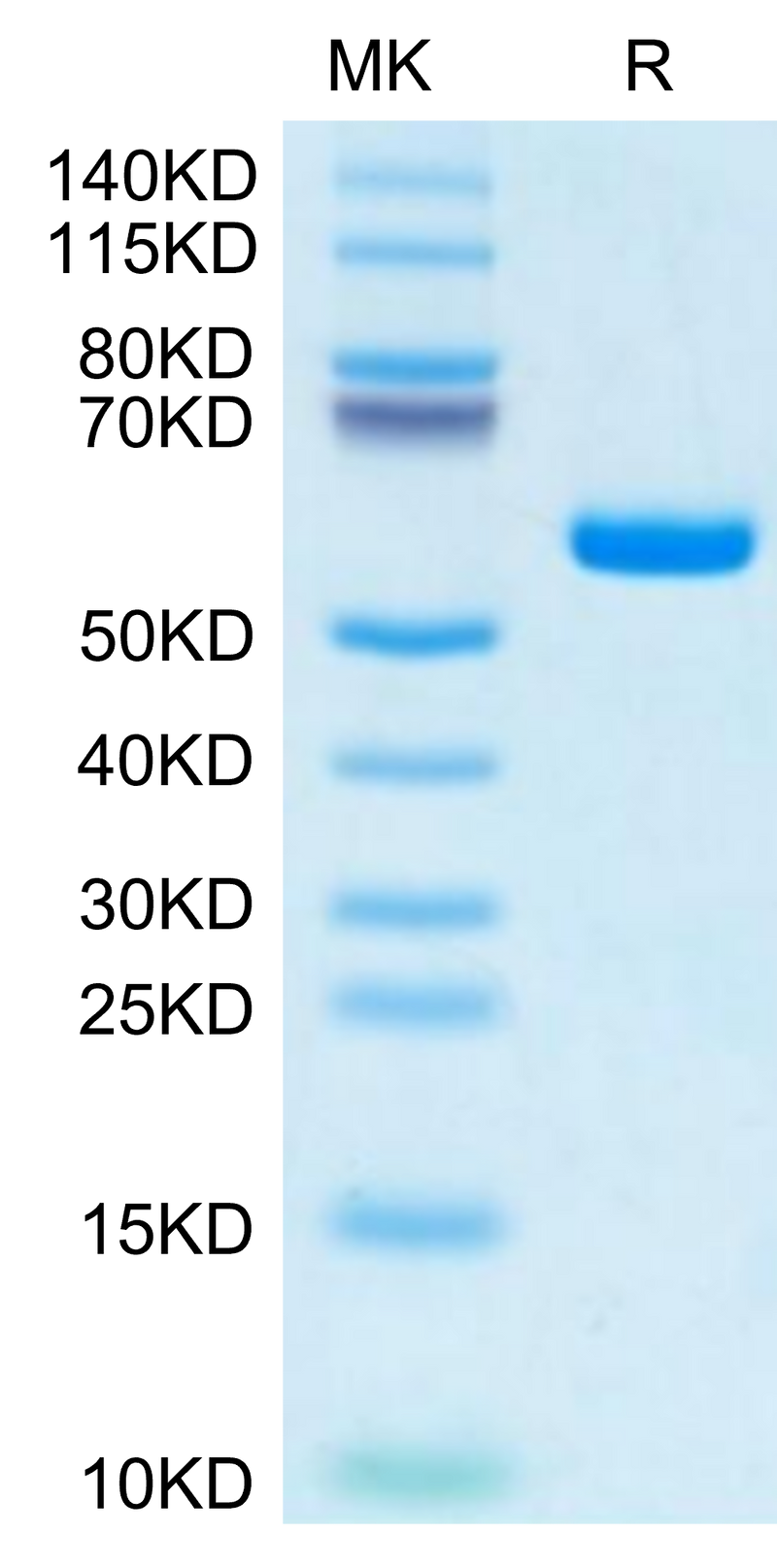 Human HLA-A*11:01&B2M&KRAS G12S (VVVGASGVGK) Monomer on Tris-Bis PAGE under reduced condition. The purity is greater than 95%.