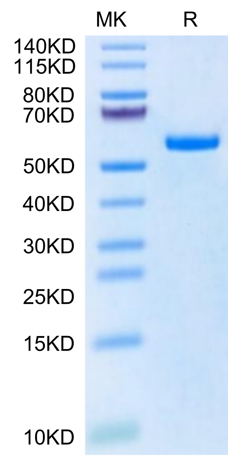 Biotinylated Human HLA-A*11:01&B2M&KRAS G12S (VVVGASGVGK) Monomer on Tris-Bis PAGE under reduced condition. The purity is greater than 95%.