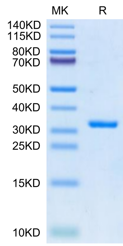 SARS-CoV-2 3CLpro (E166V) on Tris-Bis PAGE under reduced condition. The purity is greater than 95%.