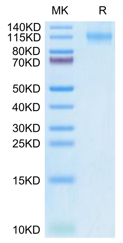 Human FLT3 on Tris-Bis PAGE under reduced condition. The purity is greater than 95%.