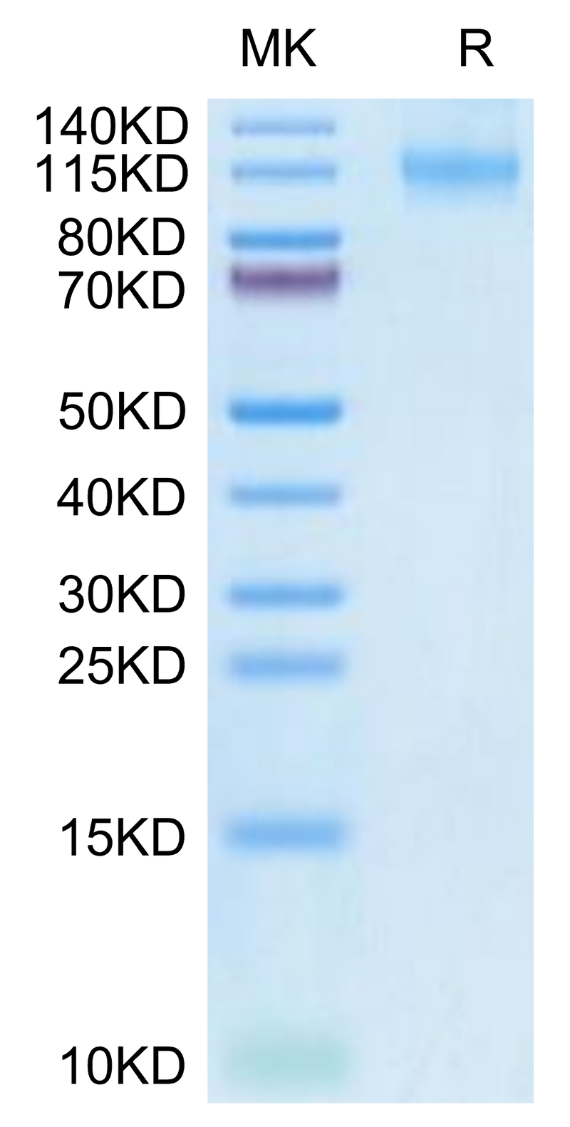 Human FLT3 on Tris-Bis PAGE under reduced condition. The purity is greater than 95%.