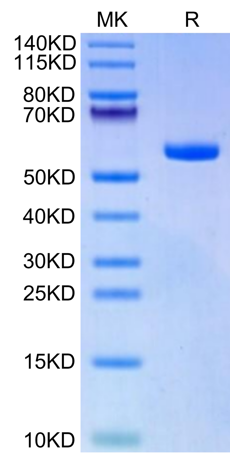 Biotinylated Human HLA-A*11:01&B2M&KRAS G12A (VVVGAAGVGK) Monomer on Tris-Bis PAGE under reduced condition. The purity is greater than 95%.