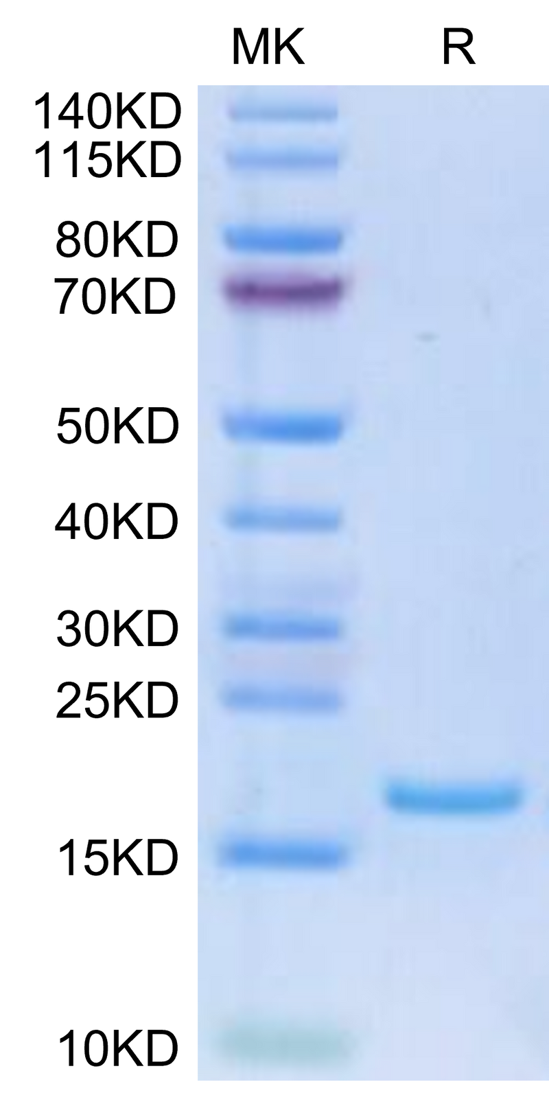 Human FLT3 Ligand on Tris-Bis PAGE under reduced condition. The purity is greater than 95%.