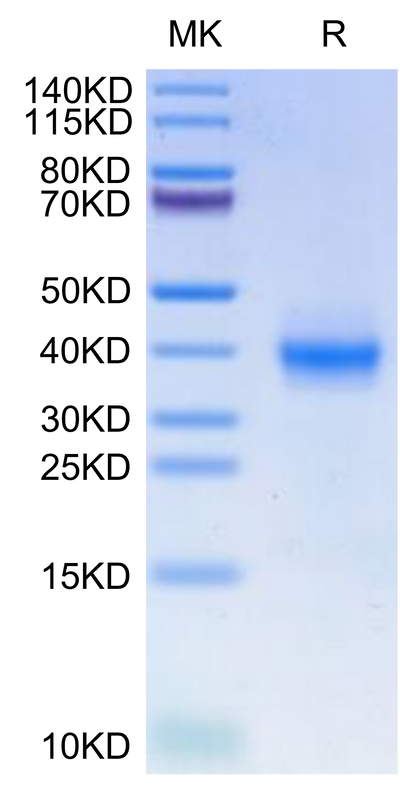 Human PD-L1 on Tris-Bis PAGE under reduced condition. The purity is greater than 95%.