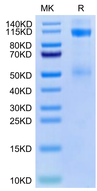 Cynomolgus IGF1R on Tris-Bis PAGE under reduced condition. The purity is greater than 95%.