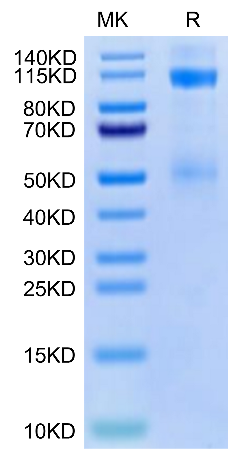 Cynomolgus IGF1R on Tris-Bis PAGE under reduced condition. The purity is greater than 95%.