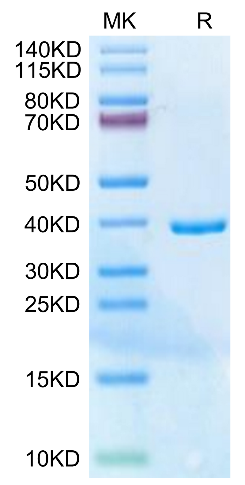 Human HLA-G Free heavy chain on Tris-Bis PAGE under reduced condition. The purity is greater than 95%.