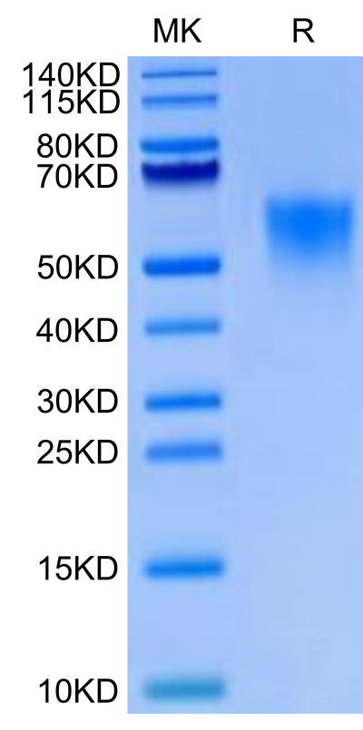 Biotinylated Cynomolgus IL-18BP on Tris-Bis PAGE under reduced condition. The purity is greater than 95%.