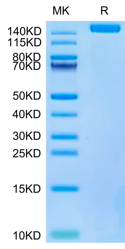 Biotinylated SARS-COV-2 Spike S Trimer on Tris-Bis PAGE under reduced condition. The purity is greater than 95%.