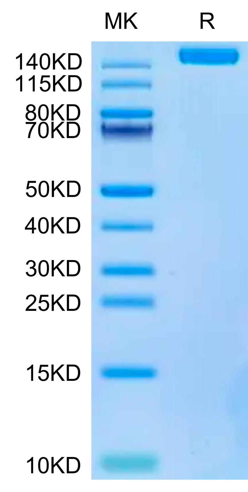 Biotinylated SARS-COV-2 Spike S Trimer on Tris-Bis PAGE under reduced condition. The purity is greater than 95%.