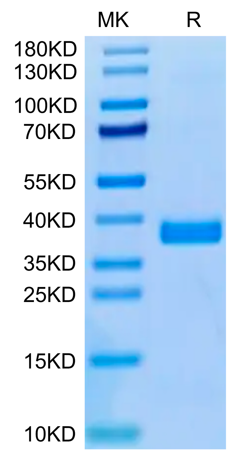 Human APOE3 on Tris-Bis PAGE under reduced condition. The purity is greater than 95%.