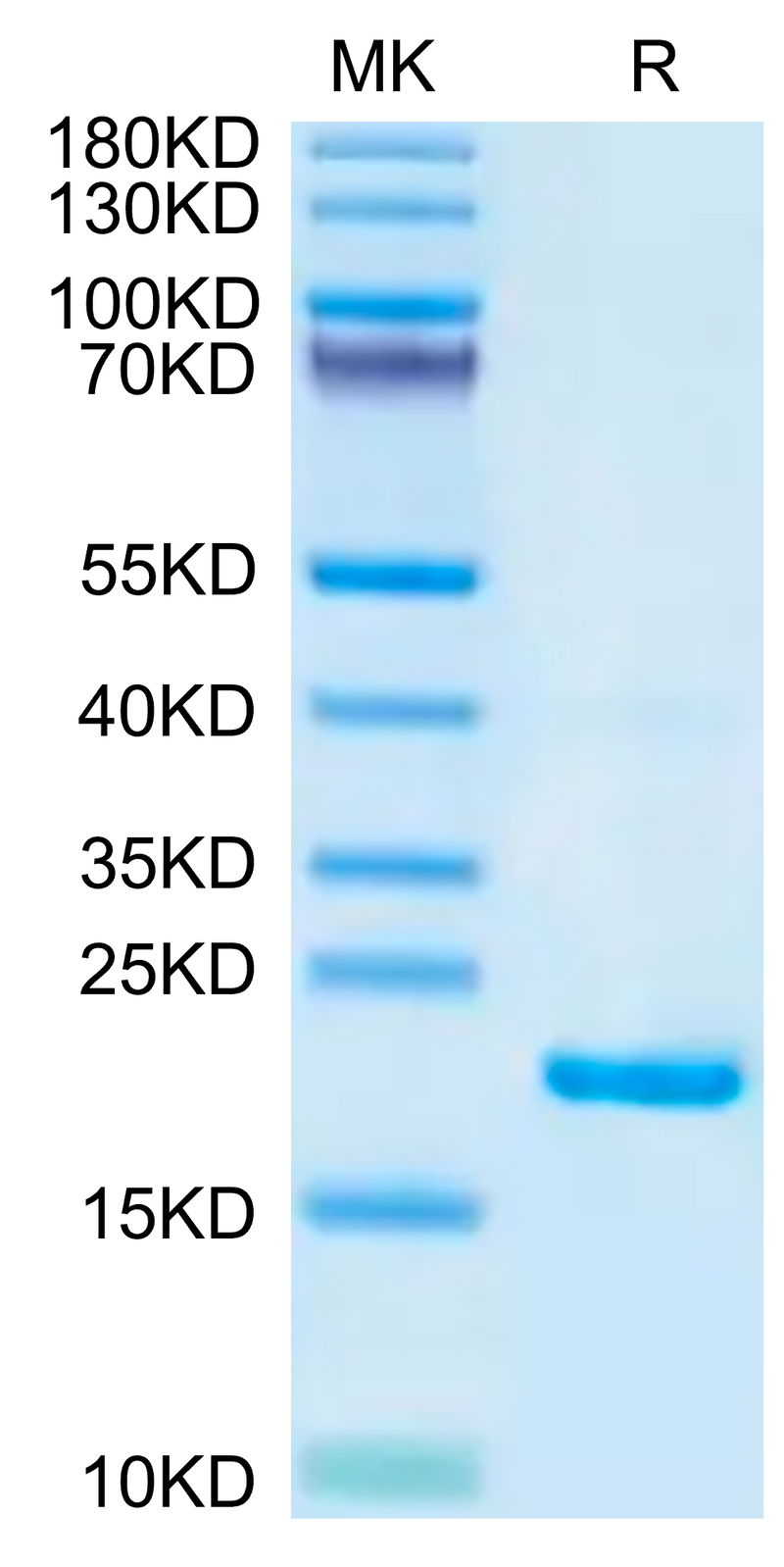 Biotinylated Mouse IL-22 on Tris-Bis PAGE under reduced condition. The purity is greater than 95%.