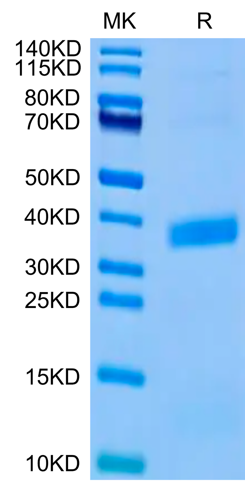 Biotinylated Human APOE3 on Tris-Bis PAGE under reduced condition. The purity is greater than 95%.