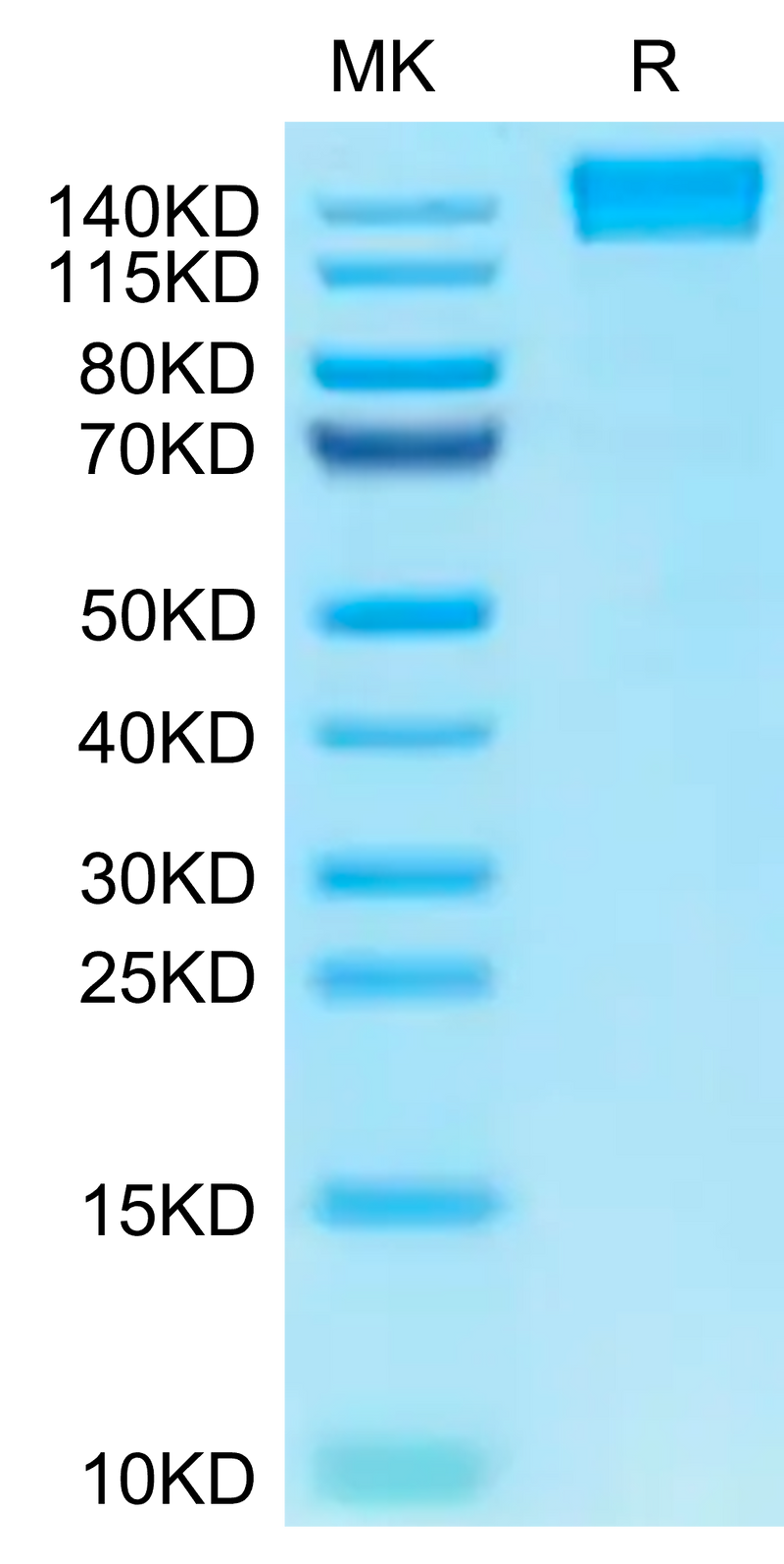 Human CD45 on Tris-Bis PAGE under reduced condition. The purity is greater than 95%.