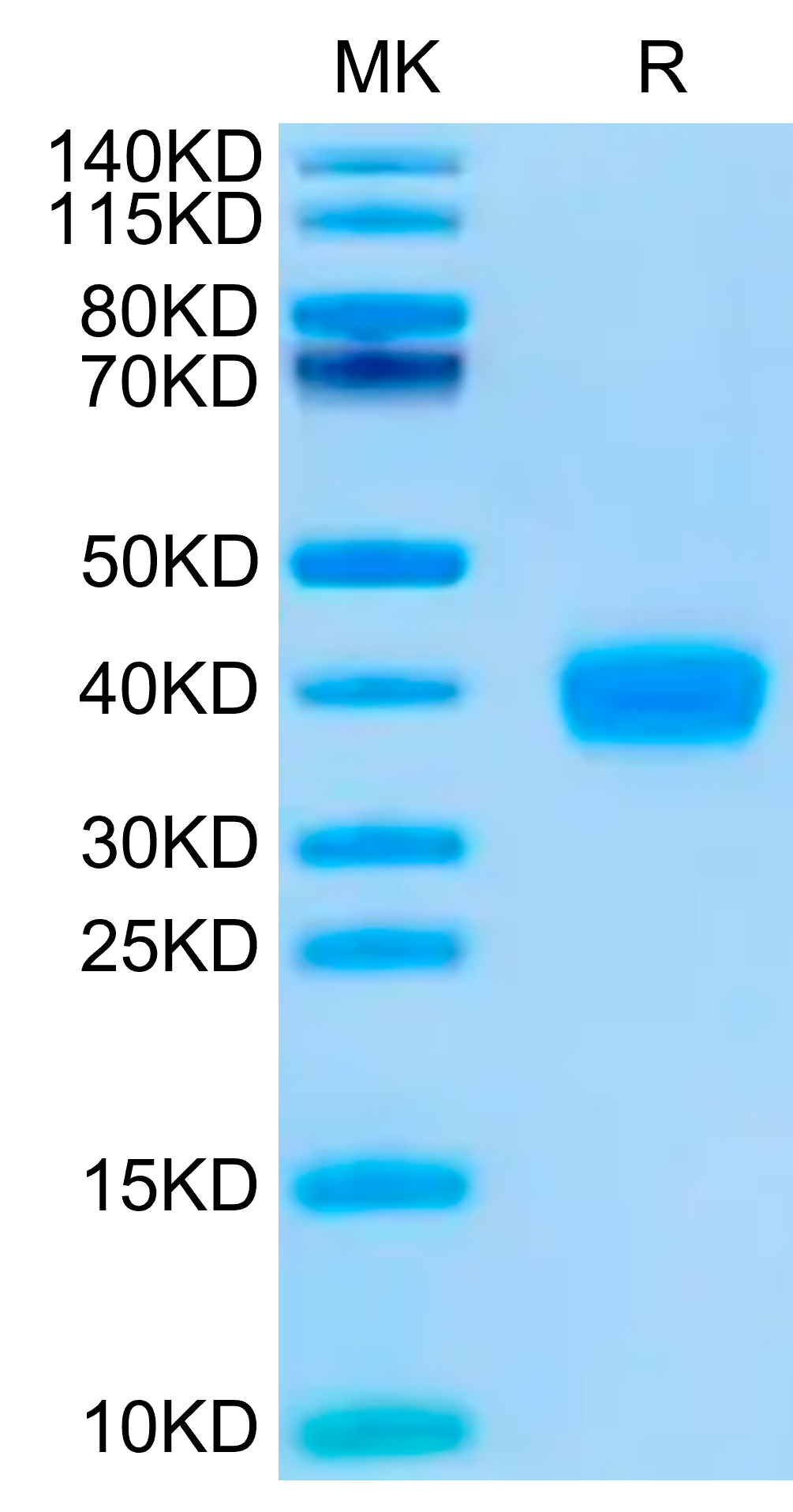 Recombinant SARS-CoV-2 Spike RBD (Omicron BQ.1.1) Protein, Active ...