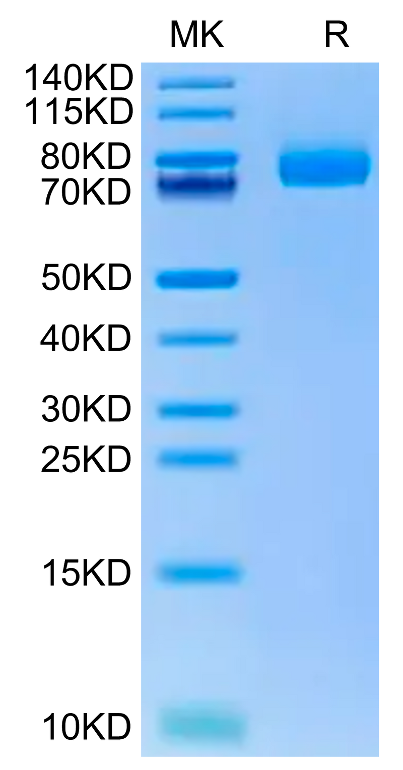 Human CD36 on Tris-Bis PAGE under reduced condition. The purity is greater than 95%.