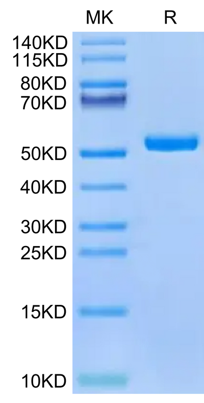 Human HLA-A*02:01&B2M&PRAME (SLLQHLIGL) Monomer on Tris-Bis PAGE under reduced condition. The purity is greater than 95%.