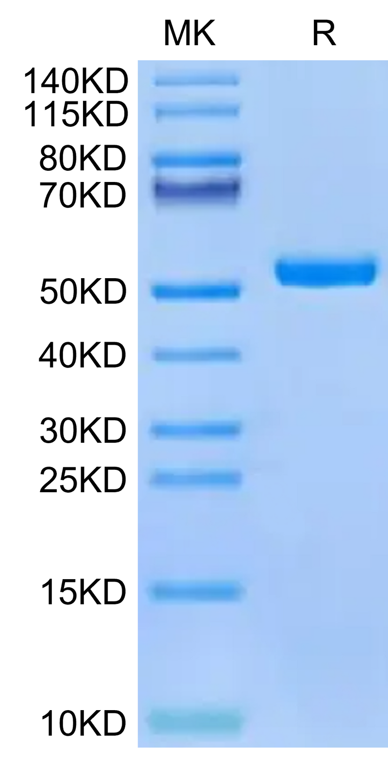 Human HLA-A*02:01&B2M&PRAME (SLLQHLIGL) Monomer on Tris-Bis PAGE under reduced condition. The purity is greater than 95%.