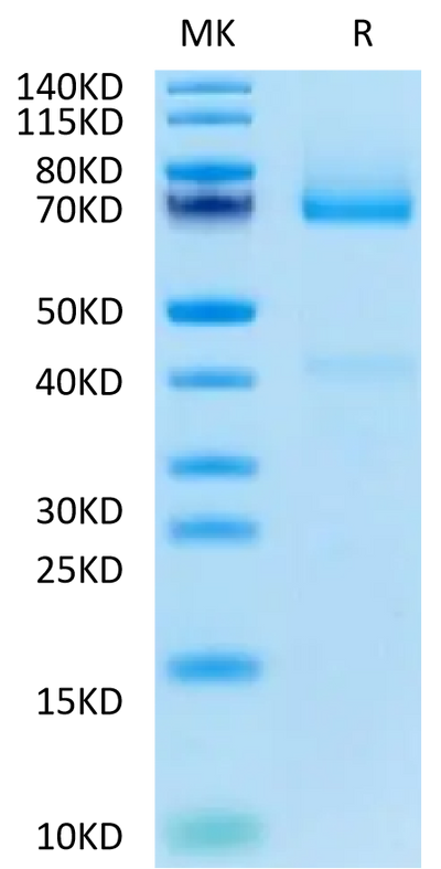 Biotinylated Human GPC3 on Tris-Bis PAGE under reduced condition. The purity is greater than 90%.