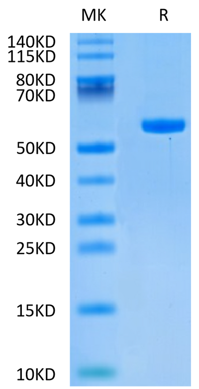 Human HLA-C 03:04&B2M&KRAS G12D (GADGVGKSAL) Monomer on Tris-Bis PAGE under reduced condition. The purity is greater than 95%.