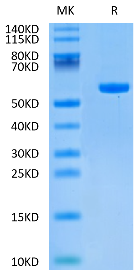 Human HLA-C 03:04&B2M&KRAS G12D (GADGVGKSAL) Monomer on Tris-Bis PAGE under reduced condition. The purity is greater than 95%.