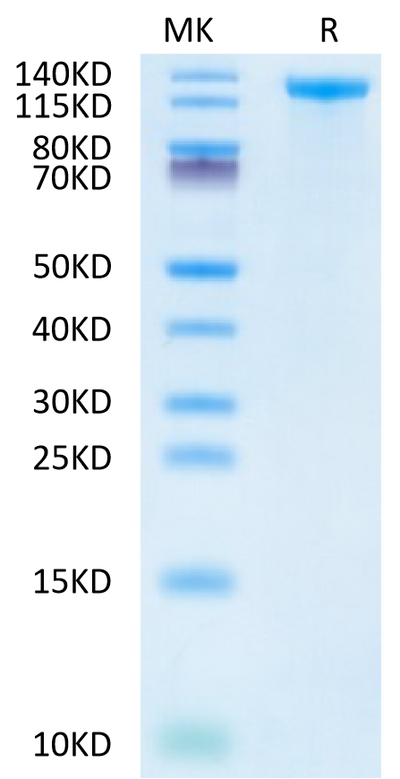 Human Jagged 1 on Tris-Bis PAGE under reduced condition. The purity is greater than 95%.